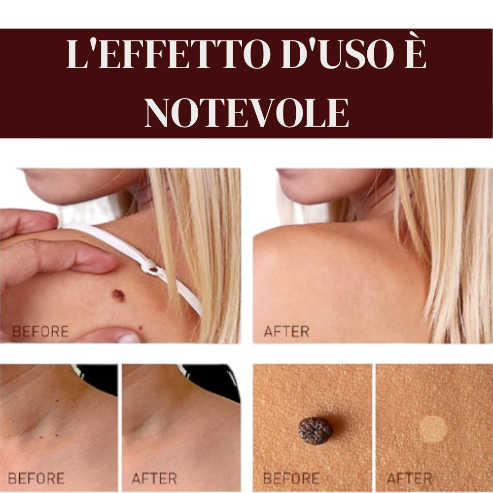 Aggiungi-un-titolo-1.png